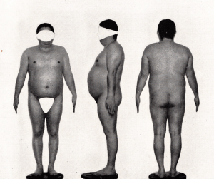 Endomorph